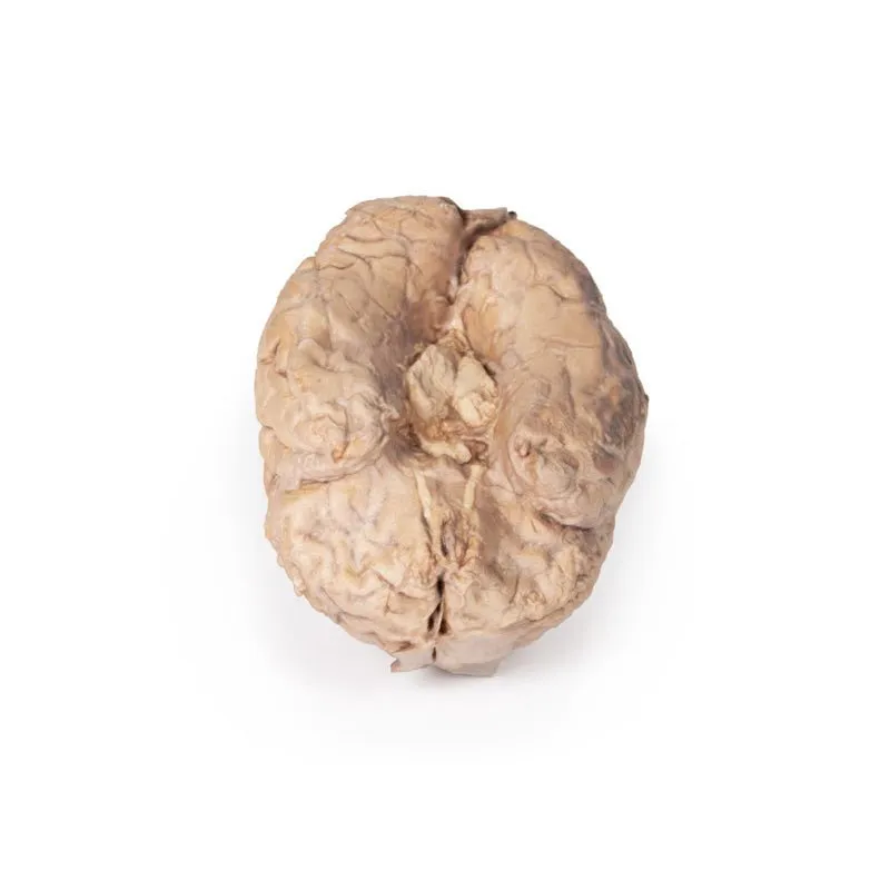 3D Printed Brain (Cerebrum)