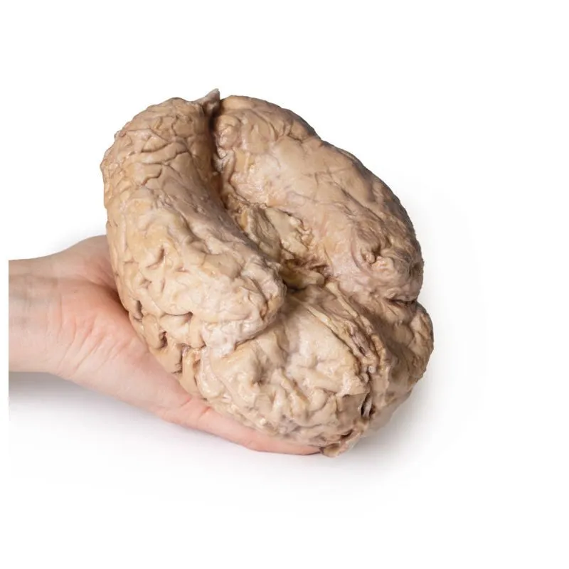 3D Printed Brain (Cerebrum)